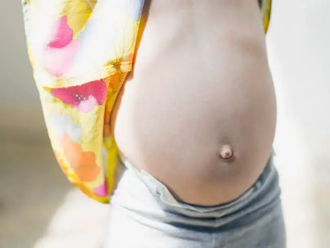 outie belly button
